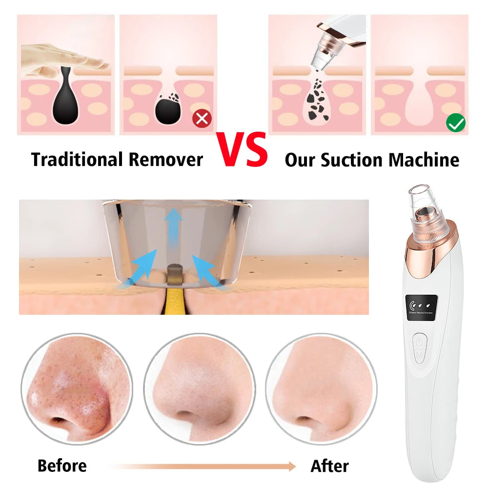 Blackhead Remover Face Deep Nose Cleaner T Zone Pore Acne Pimple Removal Vacuum Suction Facial Diamond Beauty Clean Skin Tool