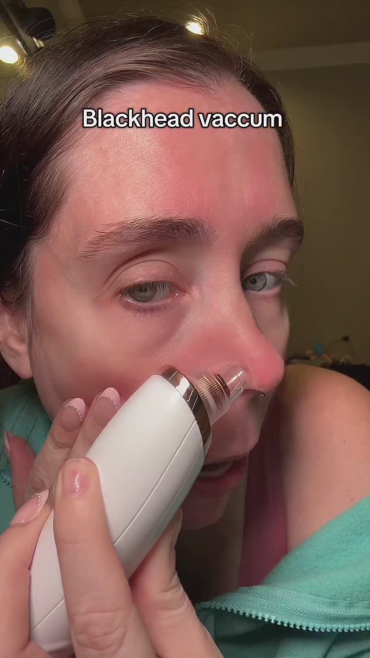 Blackhead Remover Face Deep Nose Cleaner T Zone Pore Acne Pimple Removal Vacuum Suction Facial Diamond Beauty Clean Skin Tool