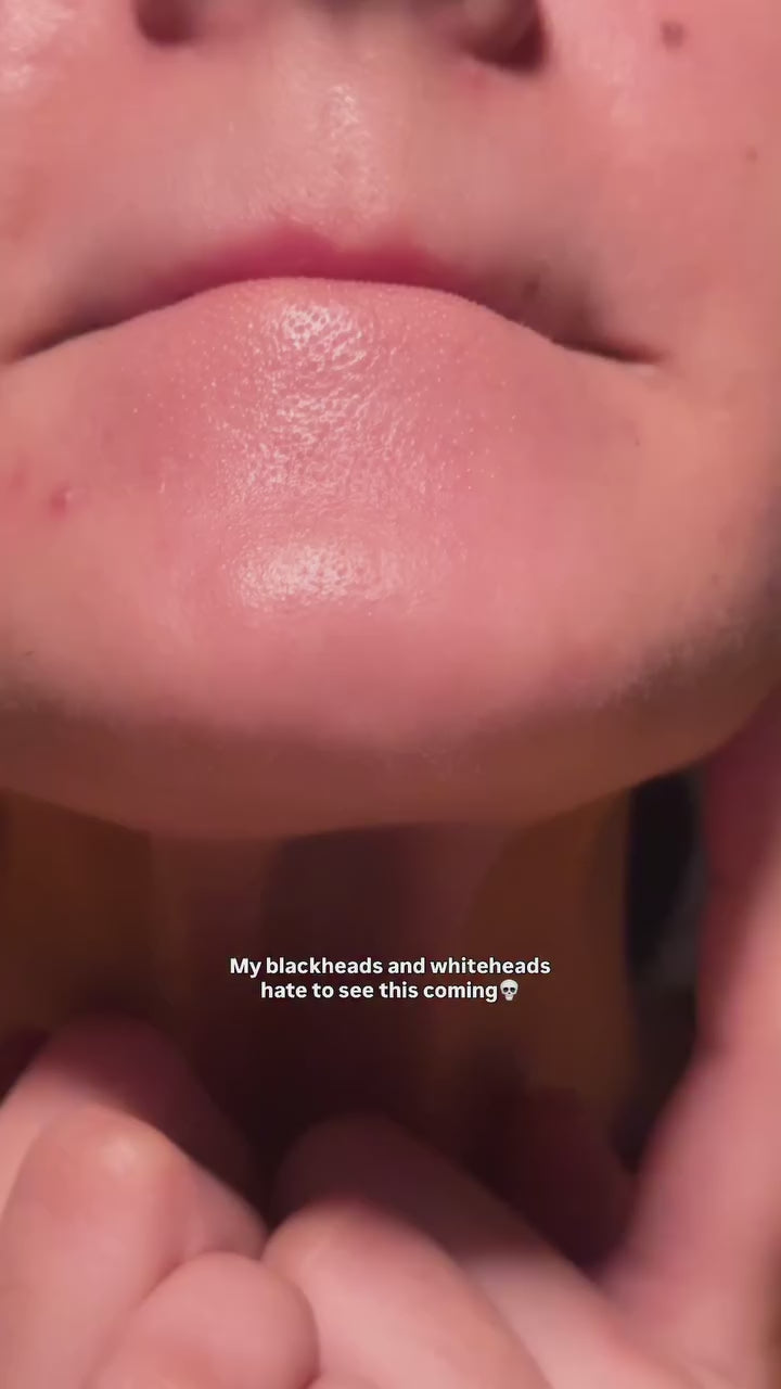 Blackhead Remover Face Deep Nose Cleaner T Zone Pore Acne Pimple Removal Vacuum Suction Facial Diamond Beauty Clean Skin Tool